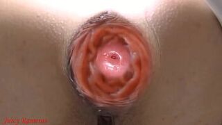 Anal slut lost her asshole prolapse while peeing in public toilet - porn video